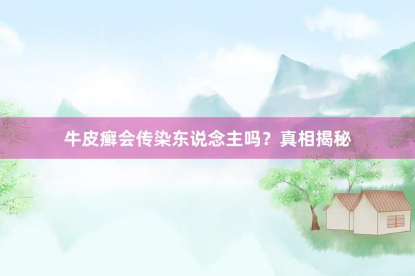牛皮癣会传染东说念主吗？真相揭秘